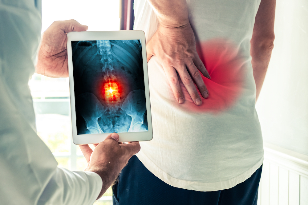 Spine X-Ray